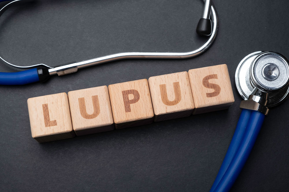 4 things to avoid when dealing with lupus